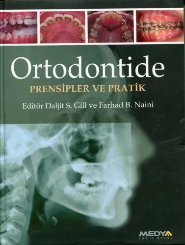 Ortodontide Prensipler ve Pratikler Ciltli